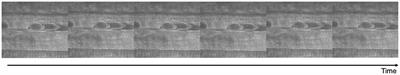 Numerical Model for the Determination of Erythrocyte Mechanical Properties and Wall Shear Stress in vivo From Intravital Microscopy